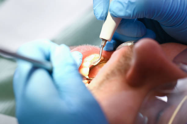 Best Dental Abscess Treatment in Watervliet, MI