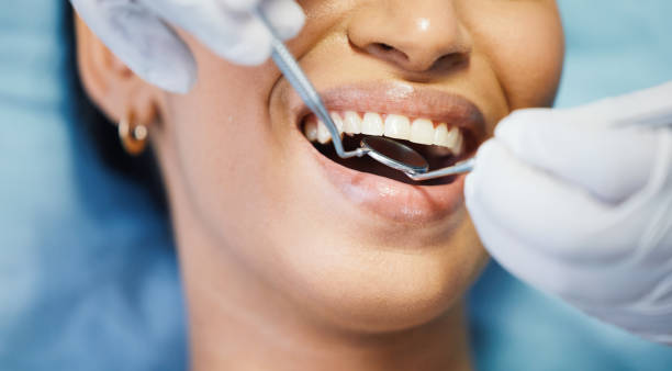 Best Emergency Root Canal Therapy in Watervliet, MI