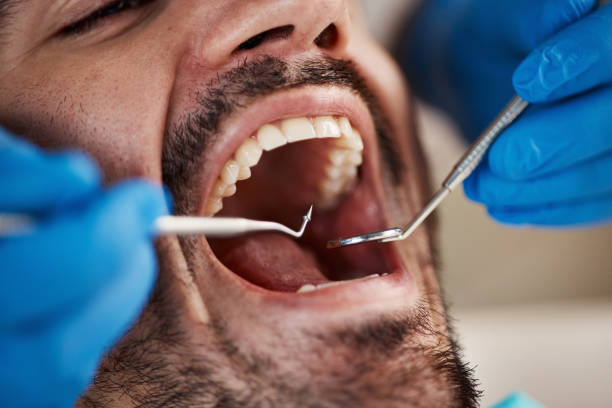 Best Dental Abscess Treatment in Watervliet, MI